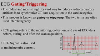 Ct   coronary  angiography edited 1st
