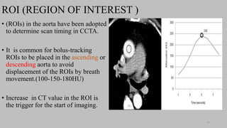 Ct   coronary  angiography edited 1st