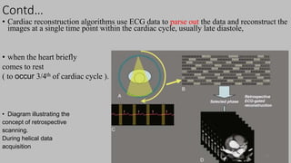 Ct   coronary  angiography edited 1st