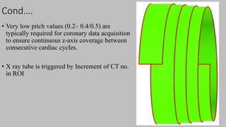 Ct   coronary  angiography edited 1st