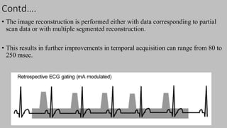 Ct   coronary  angiography edited 1st