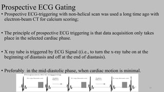 Ct   coronary  angiography edited 1st