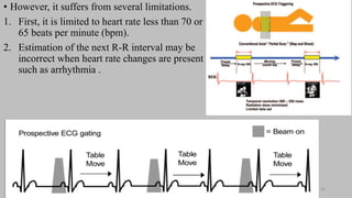 Ct   coronary  angiography edited 1st