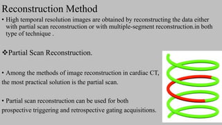 Ct   coronary  angiography edited 1st