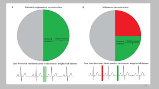 Ct   coronary  angiography edited 1st