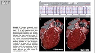Ct   coronary  angiography edited 1st