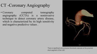 Ct   coronary  angiography edited 1st