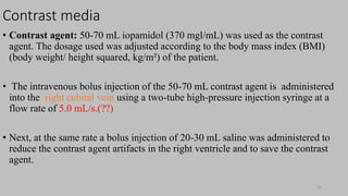 Ct   coronary  angiography edited 1st