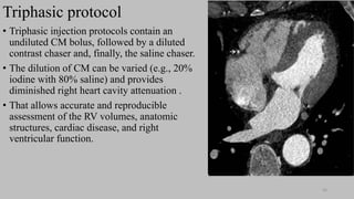 Ct   coronary  angiography edited 1st