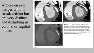 Ct   coronary  angiography edited 1st