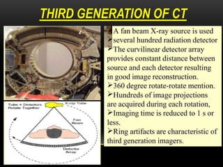 THIRD GENERATION OF CT
 