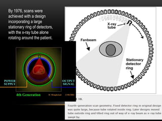 By 1976, scans were
achieved with a design
incorporating a large
stationary ring of detectors,
with the x-ray tube alone
rotating around the patient.
 