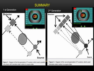 SUMMARY
1 st Generation 2nd Generation
 
