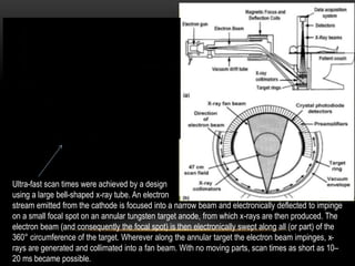 Ultra-fast scan times were achieved by a design
using a large bell-shaped x-ray tube. An electron
stream emitted from the cathode is focused into a narrow beam and electronically deflected to impinge
on a small focal spot on an annular tungsten target anode, from which x-rays are then produced. The
electron beam (and consequently the focal spot) is then electronically swept along all (or part) of the
360° circumference of the target. Wherever along the annular target the electron beam impinges, x-
rays are generated and collimated into a fan beam. With no moving parts, scan times as short as 10–
20 ms became possible.
 