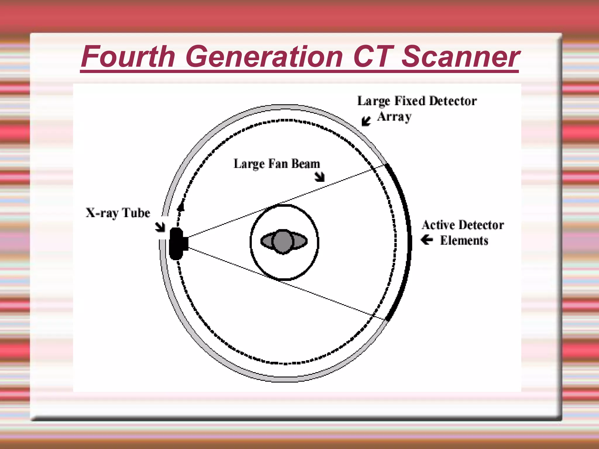 Fourth Generation CT Scanner
 