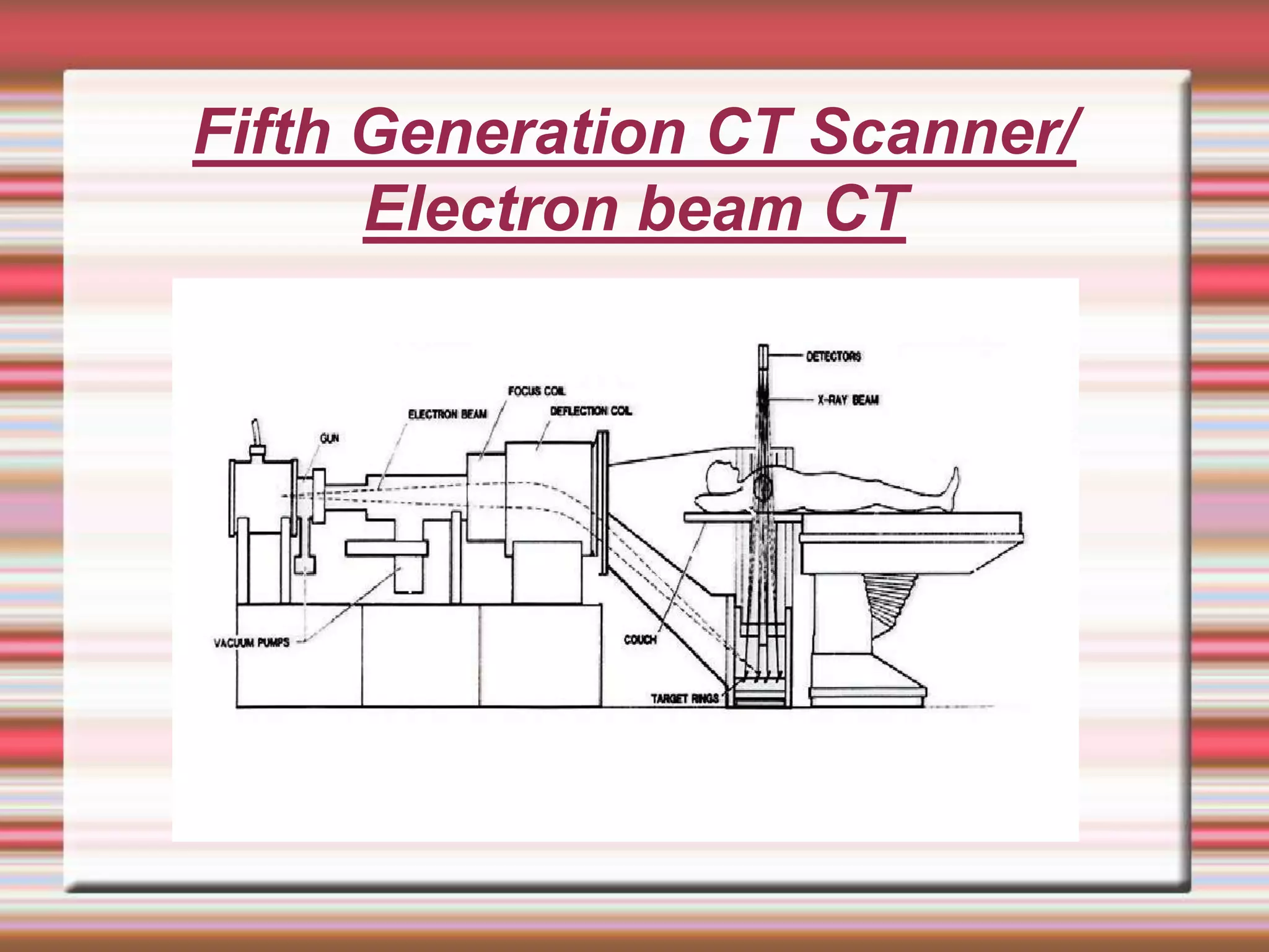 Fifth Generation CT Scanner/
Electron beam CT
 