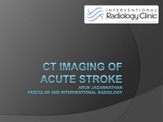 CT Imaging of acute strokeArun JagannathanVascular and Interventional Radiology 