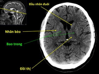 Đầu nhân đuôi
Đồi thị
Nhân bèo
Bao trong
 