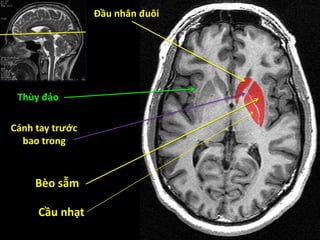 Đầu nhân đuôi
Bèo sẫm
Cầu nhạt
Thùy đảo
Cánh tay trước
bao trong
 