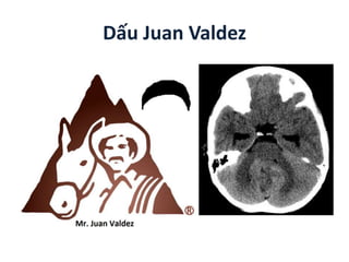 Dấu Juan Valdez
 