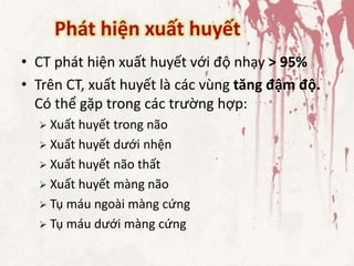 Phát hiện xuất huyết
• CT phát hiện xuất huyết với độ nhạy > 95%
• Trên CT, xuất huyết là các vùng tăng đậm độ.
Có thể gặp trong các trường hợp:
 Xuất huyết trong não
 Xuất huyết dưới nhện
 Xuất huyết não thất
 Xuất huyết màng não
 Tụ máu ngoài màng cứng
 Tụ máu dưới màng cứng
 