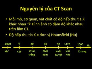 Nguyên lý của CT Scan
• Mỗi mô, cơ quan, vật chất có độ hấp thu tia X
khác nhau  Hình ảnh có đậm độ khác nhau
trên film CT.
• Độ hấp thu tia X = đơn vị Hounsfield (Hu)
 