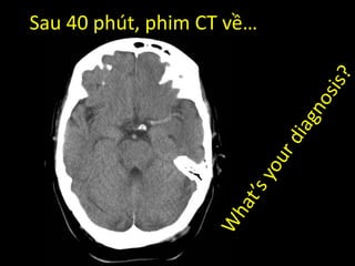 Sau 40 phút, phim CT về…
 