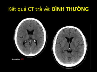 Kết quả CT trả về: BÌNH THƯỜNG
 