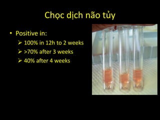 Chọc dịch não tủy
• Positive in:
 100% in 12h to 2 weeks
 >70% after 3 weeks
 40% after 4 weeks
 