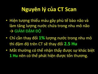 • Hiện tượng thiếu máu gây phù tế bào não và
làm tăng lượng nước chứa trong nhu mô não
→ GIẢM ĐẬM ĐỘ
• Chỉ cần thay đổi 1% lượng nước trong nhu mô
thì đậm độ trên CT sẽ thay đổi 2.5 Hu
• Mắt thường có thể nhận thấy được sự khác biệt
1 Hu nên có thể phát hiện được tổn thương.
Nguyên lý của CT Scan
 