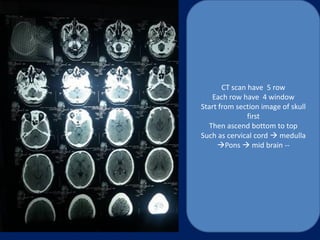 ct Scan | PDF
