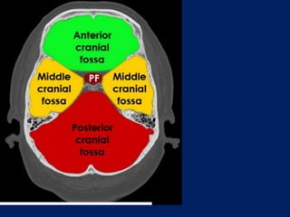ct Scan | PDF