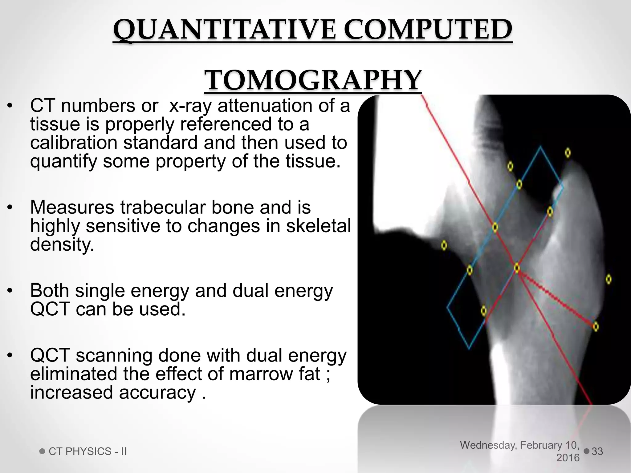 QUANTITATIVE COMPUTED
TOMOGRAPHY
• CT numbers or x-ray attenuation of a
tissue is properly referenced to a
calibration standard and then used to
quantify some property of the tissue.
• Measures trabecular bone and is
highly sensitive to changes in skeletal
density.
• Both single energy and dual energy
QCT can be used.
• QCT scanning done with dual energy
eliminated the effect of marrow fat ;
increased accuracy .
Wednesday, February 10,
2016
CT PHYSICS - II 33
 