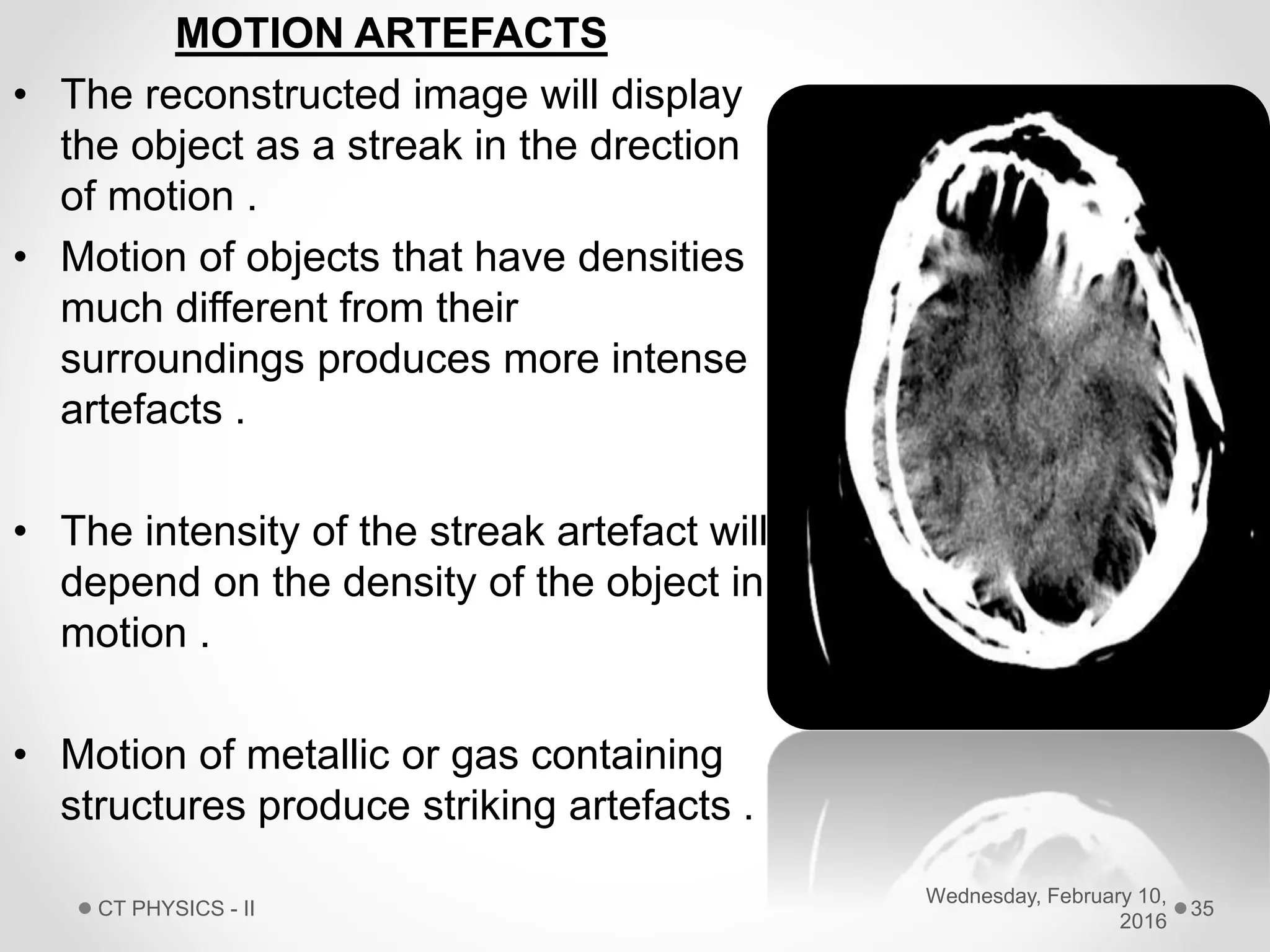 MOTION ARTEFACTS
• The reconstructed image will display
the object as a streak in the drection
of motion .
• Motion of objects that have densities
much different from their
surroundings produces more intense
artefacts .
• The intensity of the streak artefact will
depend on the density of the object in
motion .
• Motion of metallic or gas containing
structures produce striking artefacts .
Wednesday, February 10,
2016
CT PHYSICS - II 35
 