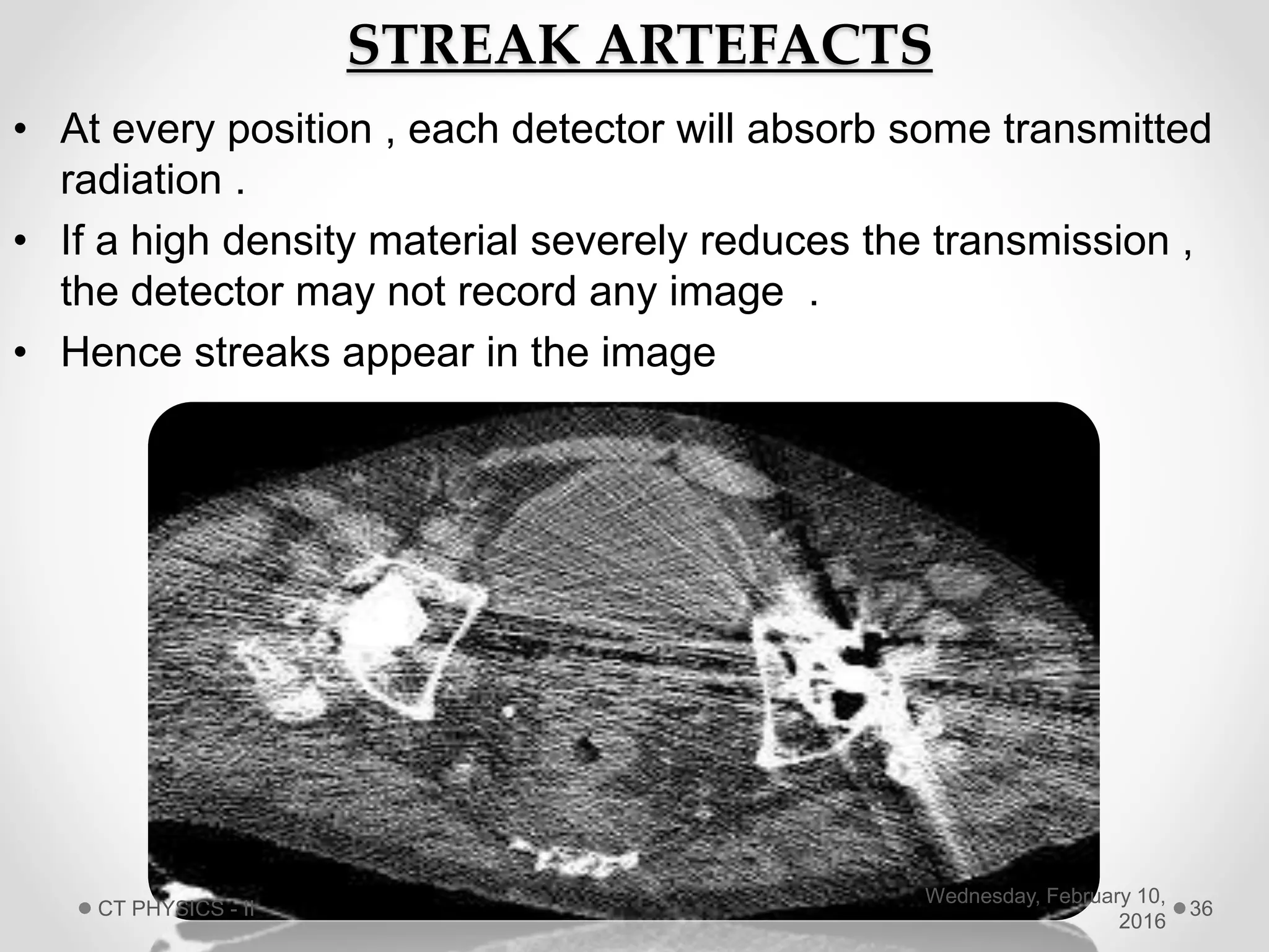 STREAK ARTEFACTS
• At every position , each detector will absorb some transmitted
radiation .
• If a high density material severely reduces the transmission ,
the detector may not record any image .
• Hence streaks appear in the image
Wednesday, February 10,
2016
CT PHYSICS - II 36
 