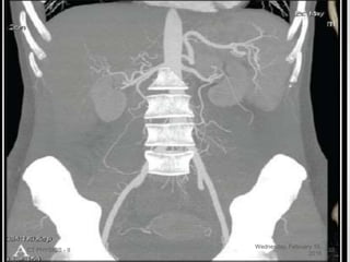 Wednesday, February 10,
2016
CT PHYSICS - II 23
 