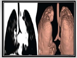 Wednesday, February 10,
2016
CT PHYSICS - II 24
 