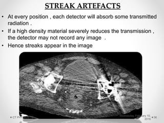 STREAK ARTEFACTS
• At every position , each detector will absorb some transmitted
radiation .
• If a high density material severely reduces the transmission ,
the detector may not record any image .
• Hence streaks appear in the image
Wednesday, February 10,
2016
CT PHYSICS - II 36
 