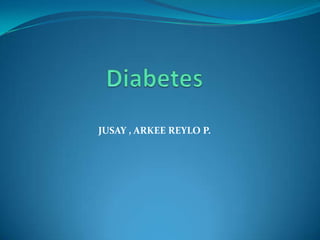 JUSAY , ARKEE REYLO P.
 