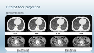 CT Image Reconstruction- Avinesh Shrestha | PPTX