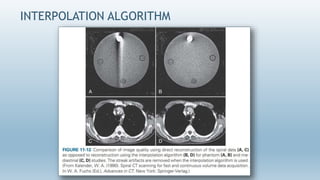Interposing Ct Module CT Image Reconstruction- Avinesh Shrestha | PPTX