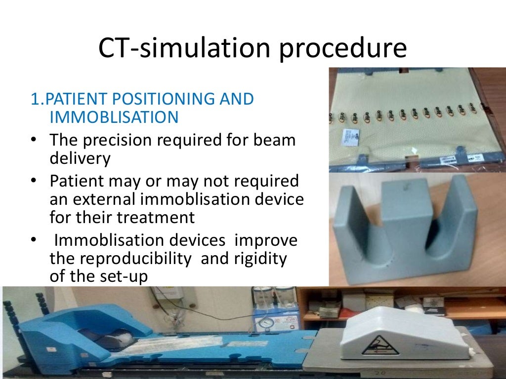 importance of ctsimulator in radiotherapy