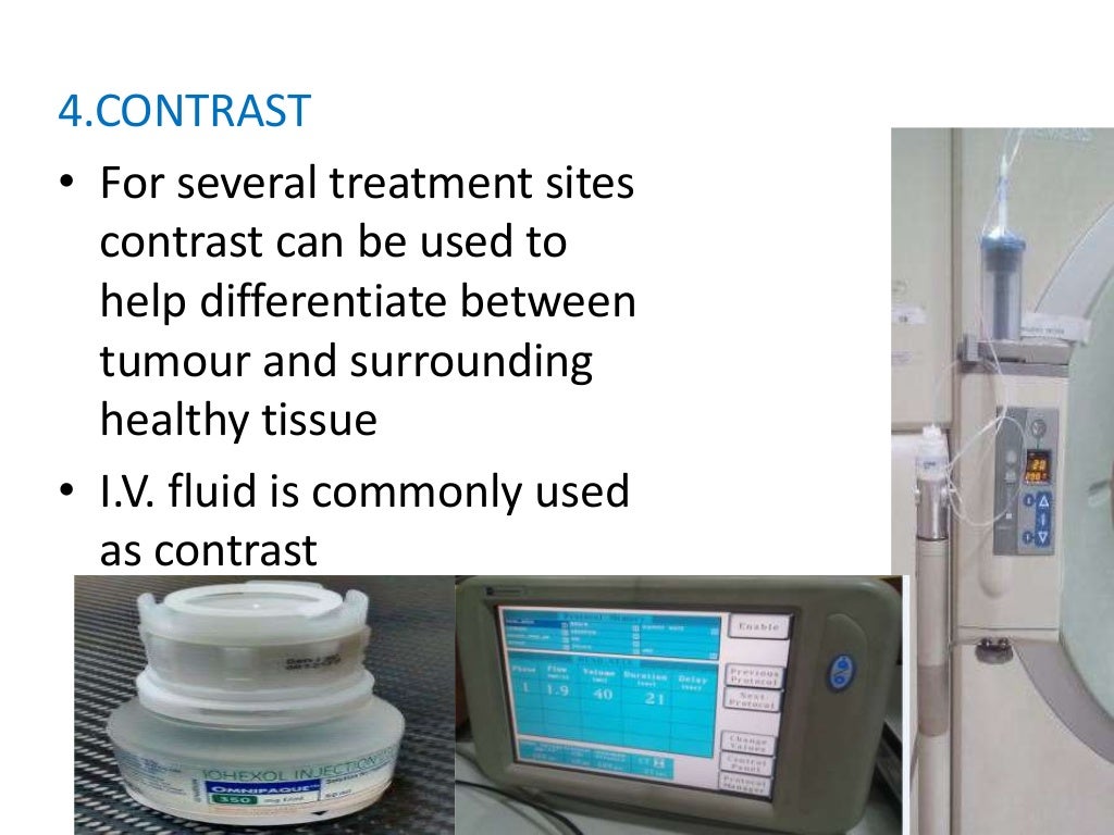 importance of ctsimulator in radiotherapy