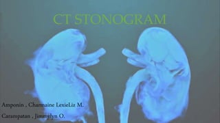 CT STONOGRAM
Amponin , Charmaine LexieLiz M.
Carampatan , Jimmylyn O.
 