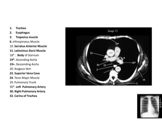 CT-transverse-anatomy: A guide on CT Scanning | PDF