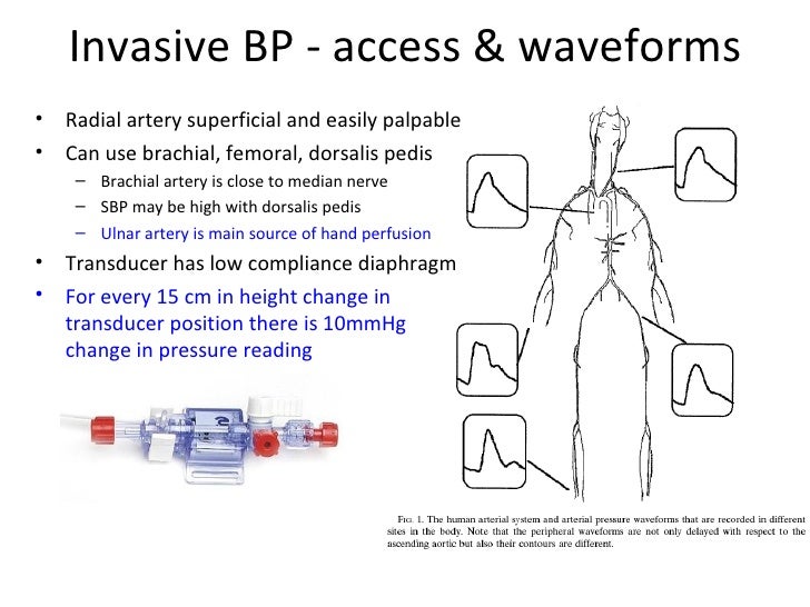 Ct1 Basic Monitoring