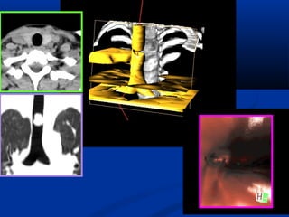 NOÄI SOI AÛO PHEÁ
QUAÛN
 