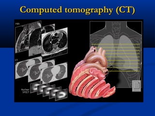 Computed tomography (CT)Computed tomography (CT)
 