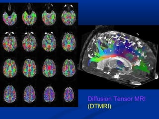 Diffusion Tensor MRI
(DTMRI)
 