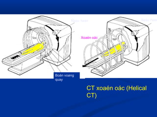 CT xoaén oác (Helical
CT)
CT qui öôùc (Conventional
CT)
Ñaàu ñeøn Ñaàu ñeøn
Boán voøng
quay
Xoaén oác
 